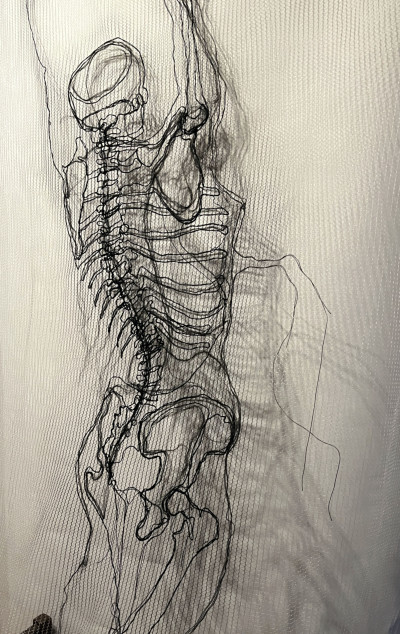 Structure