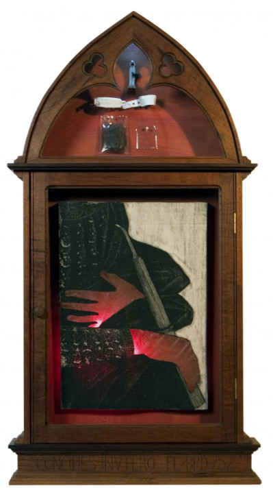 Parturition Umbilicus