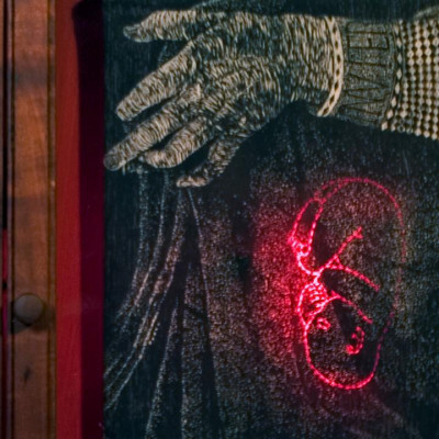 Parturition Mucosa - detail