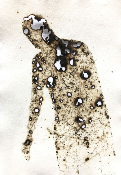 Burn #2