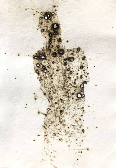 Burn #5